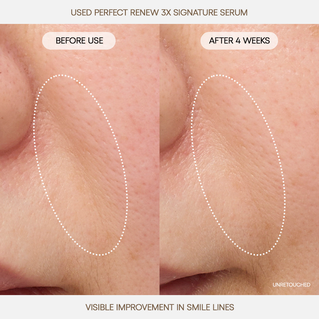Perfect Renew 3X Signature Serum - Image 4